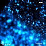 Confocal and STED image of clathrin
